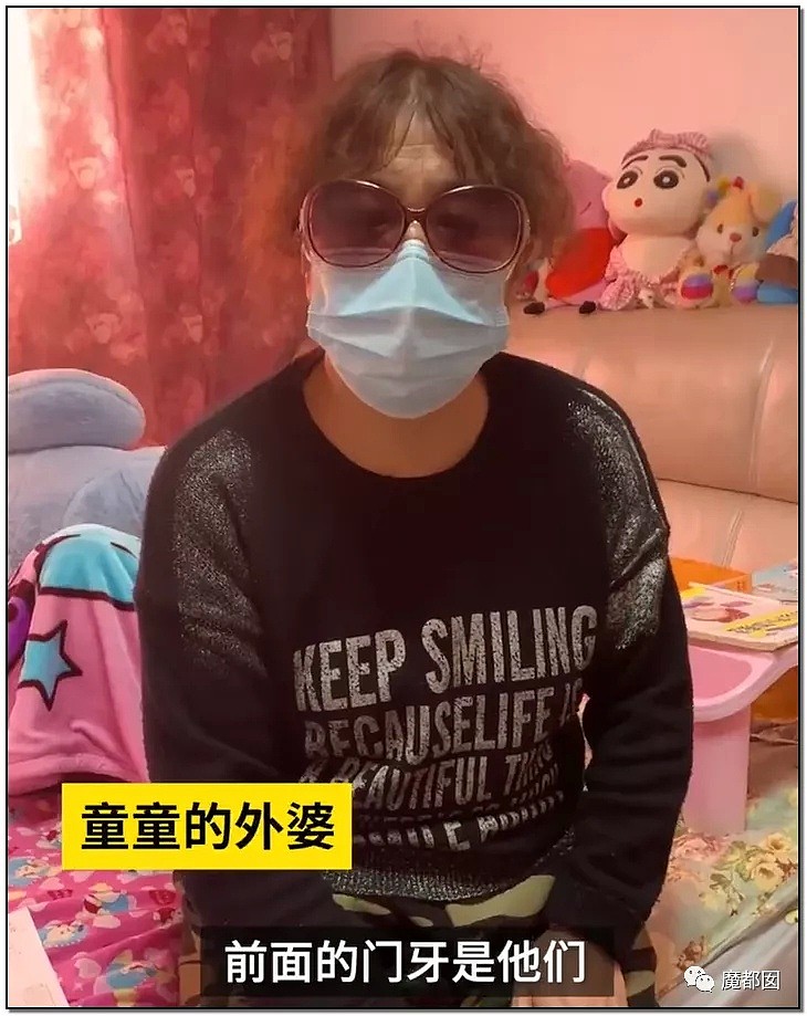 内幕扒出！沸水浇、钳拔牙、掰碎手、烧嘴唇…中国6岁女童被亲妈虐惨（视频/组图） - 6
