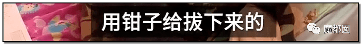 内幕扒出！沸水浇、钳拔牙、掰碎手、烧嘴唇…中国6岁女童被亲妈虐惨（视频/组图） - 7
