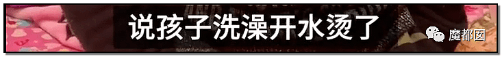 内幕扒出！沸水浇、钳拔牙、掰碎手、烧嘴唇…中国6岁女童被亲妈虐惨（视频/组图） - 39