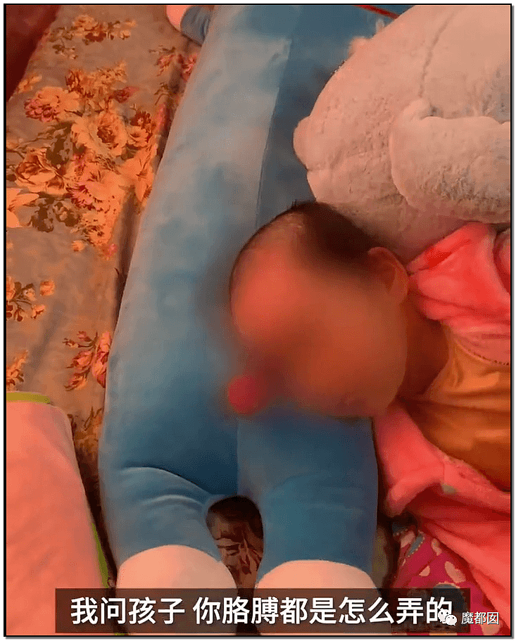 内幕扒出！沸水浇、钳拔牙、掰碎手、烧嘴唇…中国6岁女童被亲妈虐惨（视频/组图） - 51