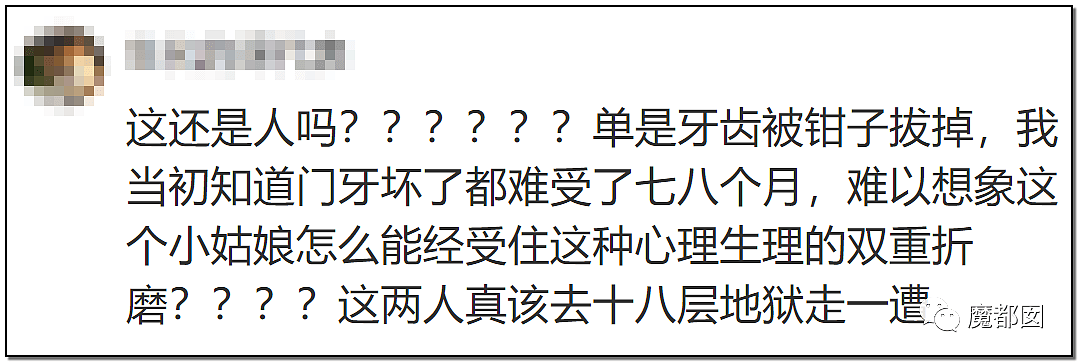 内幕扒出！沸水浇、钳拔牙、掰碎手、烧嘴唇…中国6岁女童被亲妈虐惨（视频/组图） - 101