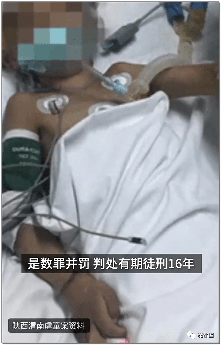 内幕扒出！沸水浇、钳拔牙、掰碎手、烧嘴唇…中国6岁女童被亲妈虐惨（视频/组图） - 108