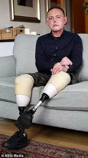 澳洲老太昏迷9天丧命，只因被猫舔了一口！因为被狗舔， 他们面部毁容、全身红斑， 四肢坏死…（组图） - 12