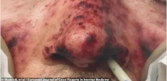 澳洲老太昏迷9天丧命，只因被猫舔了一口！因为被狗舔， 他们面部毁容、全身红斑， 四肢坏死…（组图） - 21