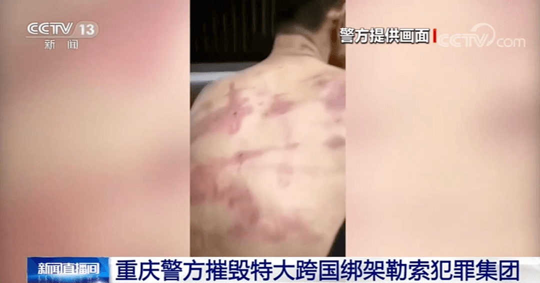 触目惊心！数百中国人境外赌博遭虐待，有人被竹签子插十指（视频/组图） - 9