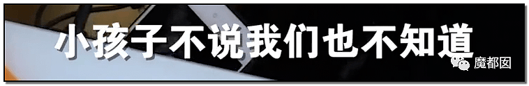 发抖！疯狂兽父烟头打火机狠烧，7岁幼儿烫伤腐烂面临截肢，画面不堪入目（组图） - 29