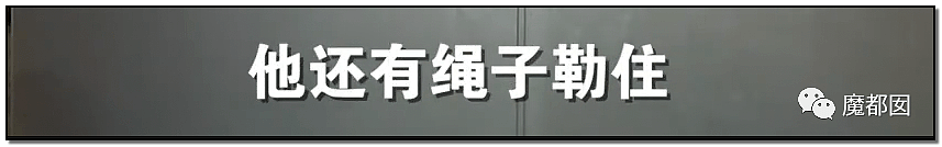 发抖！疯狂兽父烟头打火机狠烧，7岁幼儿烫伤腐烂面临截肢，画面不堪入目（组图） - 41