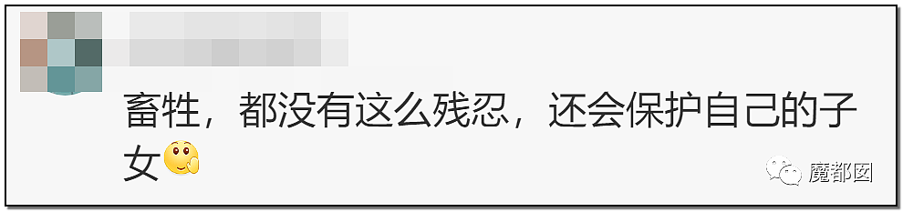 发抖！疯狂兽父烟头打火机狠烧，7岁幼儿烫伤腐烂面临截肢，画面不堪入目（组图） - 77