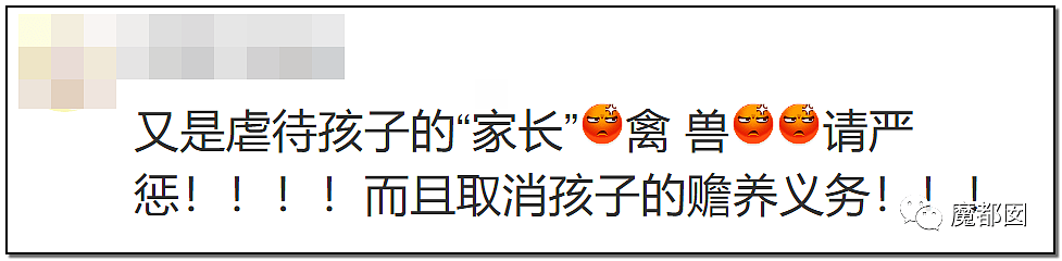 发抖！疯狂兽父烟头打火机狠烧，7岁幼儿烫伤腐烂面临截肢，画面不堪入目（组图） - 78