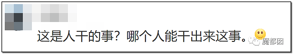 发抖！疯狂兽父烟头打火机狠烧，7岁幼儿烫伤腐烂面临截肢，画面不堪入目（组图） - 79