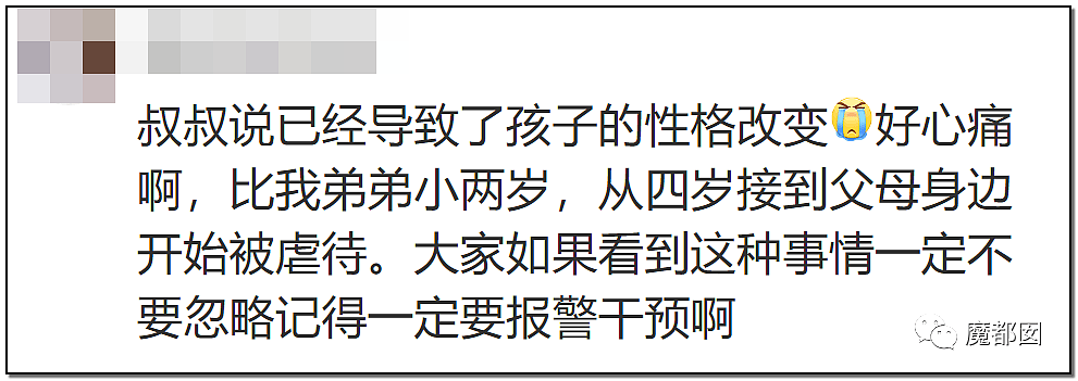 发抖！疯狂兽父烟头打火机狠烧，7岁幼儿烫伤腐烂面临截肢，画面不堪入目（组图） - 82