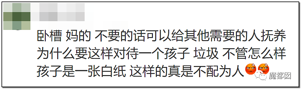 发抖！疯狂兽父烟头打火机狠烧，7岁幼儿烫伤腐烂面临截肢，画面不堪入目（组图） - 87