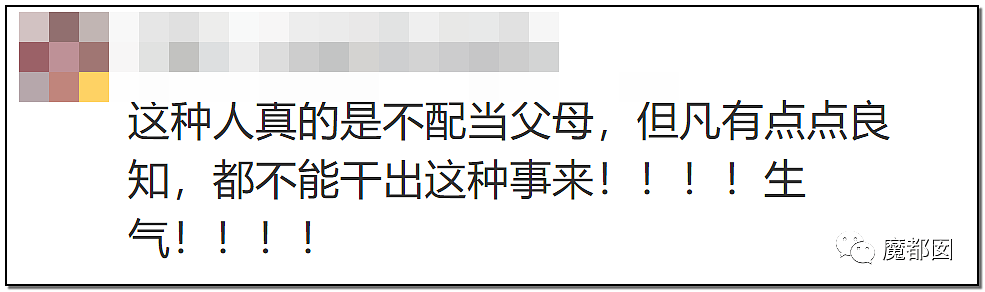 发抖！疯狂兽父烟头打火机狠烧，7岁幼儿烫伤腐烂面临截肢，画面不堪入目（组图） - 85