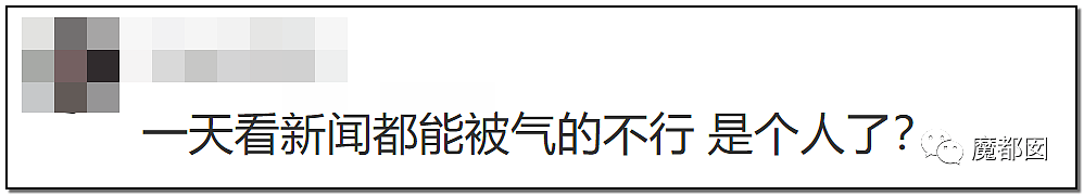 发抖！疯狂兽父烟头打火机狠烧，7岁幼儿烫伤腐烂面临截肢，画面不堪入目（组图） - 84