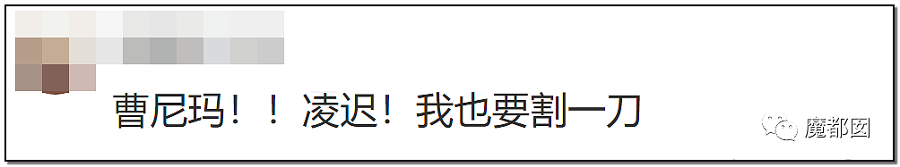 发抖！疯狂兽父烟头打火机狠烧，7岁幼儿烫伤腐烂面临截肢，画面不堪入目（组图） - 83