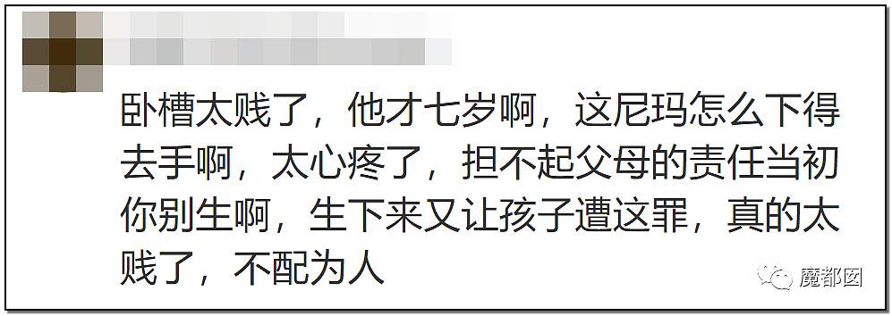 发抖！疯狂兽父烟头打火机狠烧，7岁幼儿烫伤腐烂面临截肢，画面不堪入目（组图） - 88