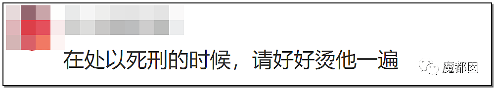 发抖！疯狂兽父烟头打火机狠烧，7岁幼儿烫伤腐烂面临截肢，画面不堪入目（组图） - 89