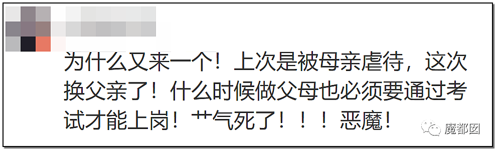 发抖！疯狂兽父烟头打火机狠烧，7岁幼儿烫伤腐烂面临截肢，画面不堪入目（组图） - 93