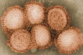 加拿大出现罕见病毒变异，已有人感染（组图） - 10