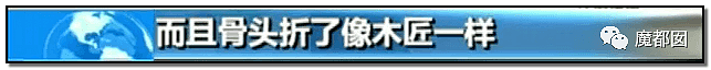 心脏支架竟可从1万3降到700！到底是谁在吸中国老百姓的血汗钱？（组图） - 77