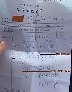 不幸！中国小伙街头遭陌生男子强奸，导致肛门出血严重，确诊抑郁症（视频/组图） - 12