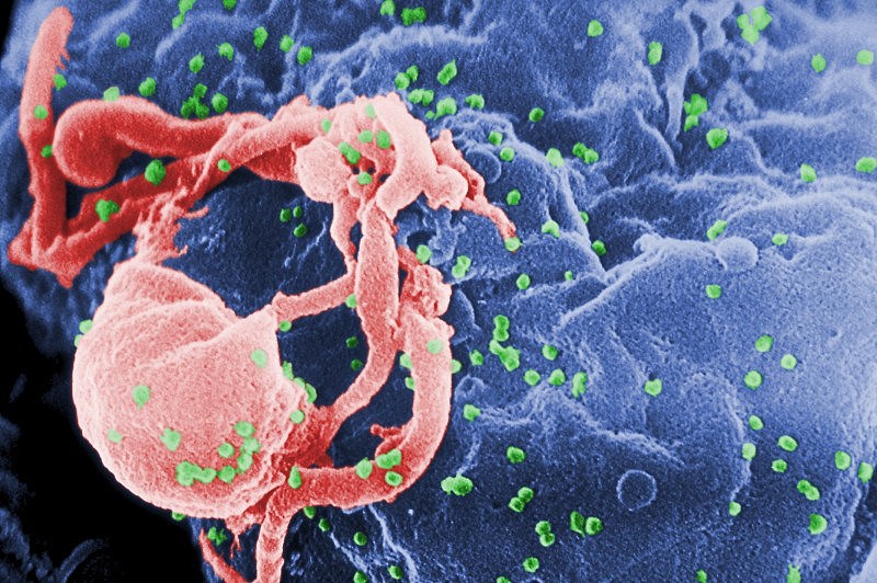 HIV-budding-Color.jpg,0