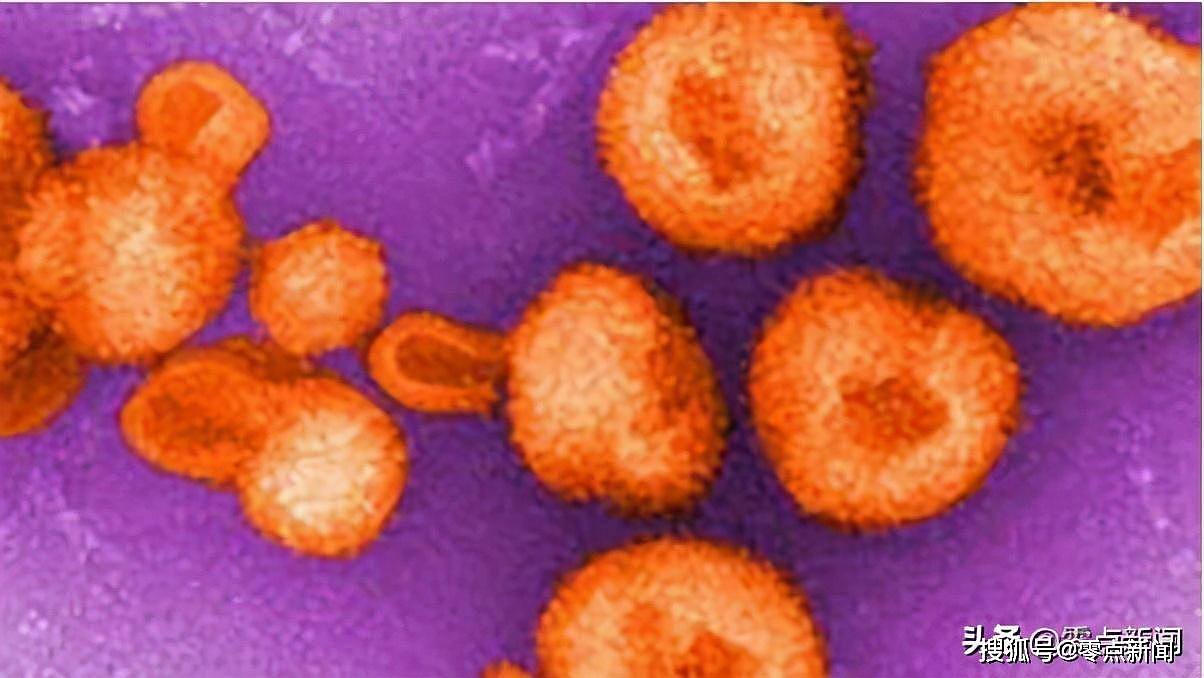 美国研究人员发现一种人传人罕见病毒，暂时无特定药物（图） - 2