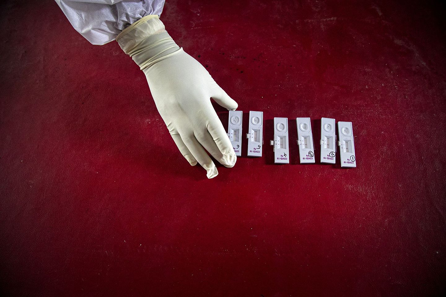 图为一名印度卫生工作者在展示他采集的鼻拭子样本。印度的新冠病例已跃居世界第二。（美联社）