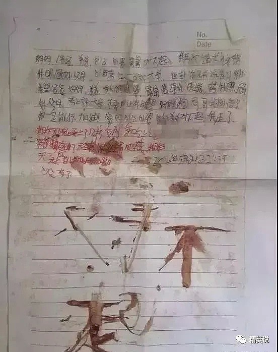 中国一小学生遭同学围殴！衣服被塞鞭炮、还被拖鞋抽脸：“我从欺压弱小中找到了快感”（视频/组图） - 11