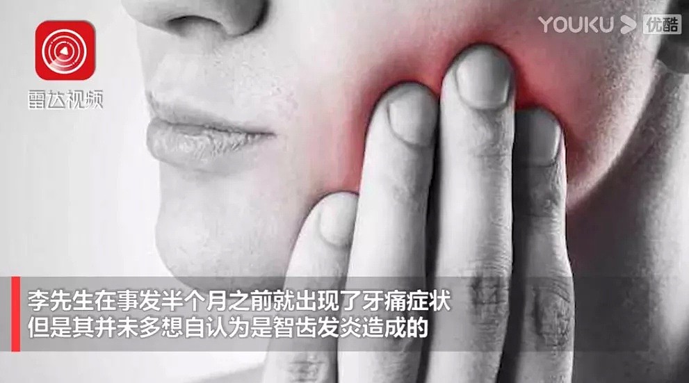 赵本山徒弟突发心梗去世，中国男子牙痛半个月后猝死！澳洲医生揭露真相（视频/组图） - 17