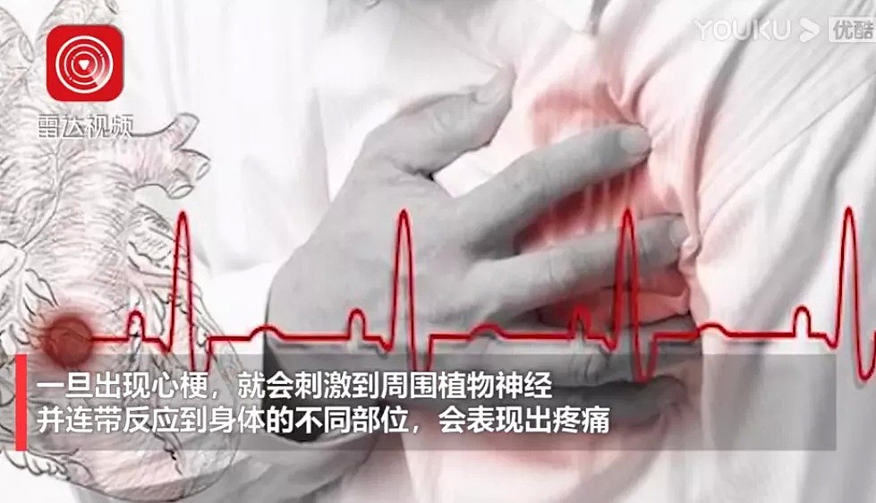赵本山徒弟突发心梗去世，中国男子牙痛半个月后猝死！澳洲医生揭露真相（视频/组图） - 22