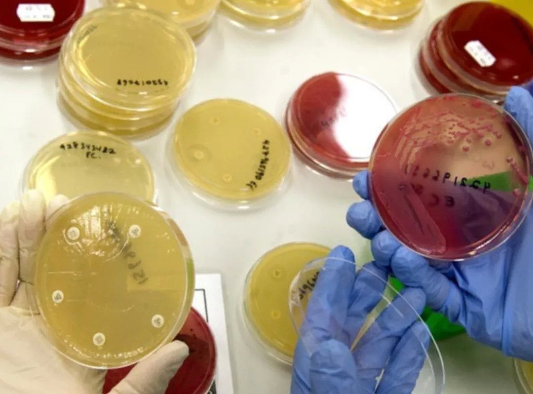 莫纳什专家警告：警惕超级细菌，每年或致2万澳人死亡！这种常见生物竟是感染源... - 4