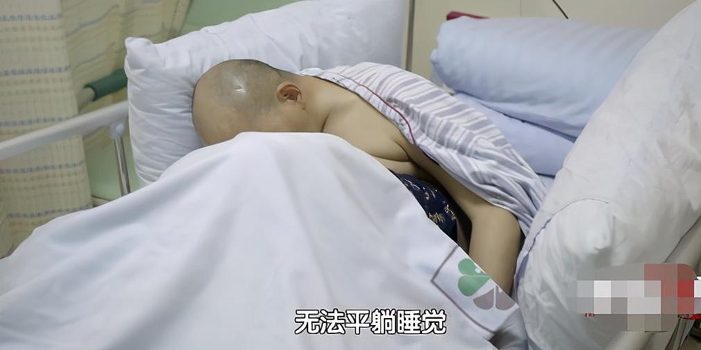 骨头被打入22根钢钉，身体被“敲断”4次：弯了28年后的中国男子，终于变直了！（组图） - 8