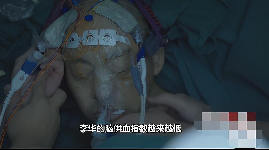 骨头被打入22根钢钉，身体被“敲断”4次：弯了28年后的中国男子，终于变直了！（组图） - 34