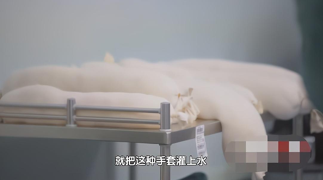 骨头被打入22根钢钉，身体被“敲断”4次：弯了28年后的中国男子，终于变直了！（组图） - 39
