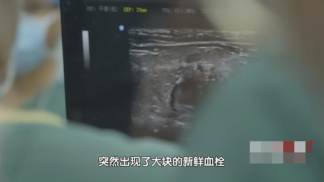 骨头被打入22根钢钉，身体被“敲断”4次：弯了28年后的中国男子，终于变直了！（组图） - 42