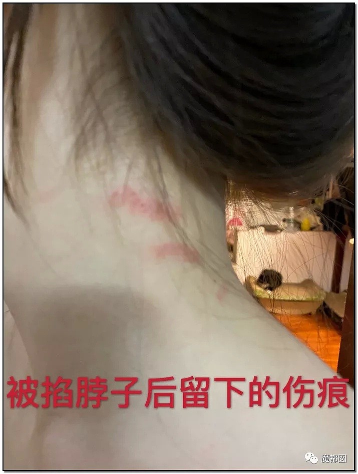 狗血反转？短跑传奇张培萌哭诉被妻子抓破鸡蛋黄、拿刀追砍？（组图） - 16