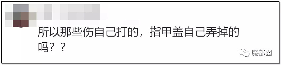 狗血反转？短跑传奇张培萌哭诉被妻子抓破鸡蛋黄、拿刀追砍？（组图） - 33