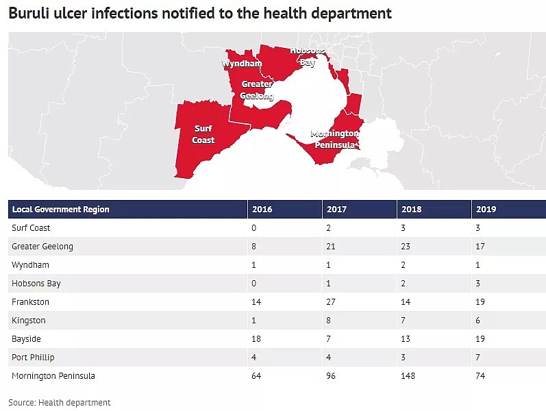 维州再现致命噬肉菌，近期感染人数飙升！墨尔本护士惨中招，每年多人因此丧命... - 30