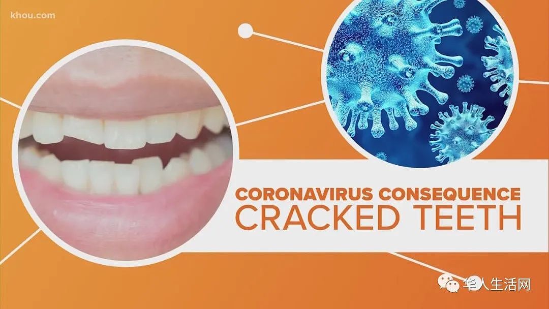 注意！最新发现：牙齿出现这些问题，很有可能是你感染了新冠病毒（组图） - 3