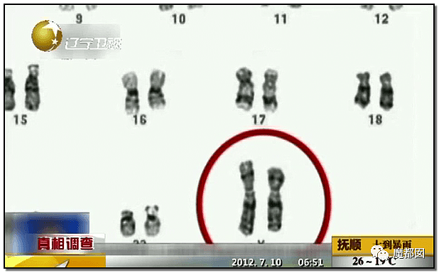 毁三观！中国父母让儿子切除子宫卵巢曝出转胎丸的惊天隐秘（组图） - 20