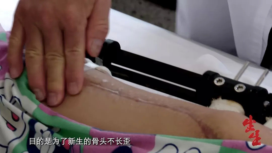 3位中国妈妈接连查出癌症：对自己太狠，真的可能会要命…（组图） - 8