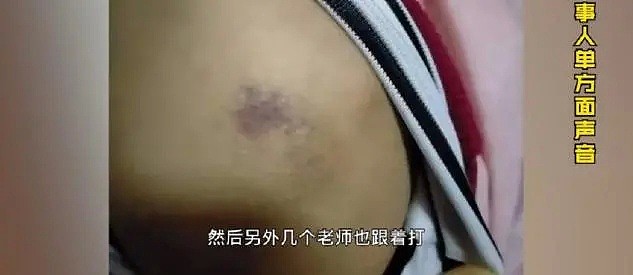 震惊！贵州初三女生遭4名老师围殴浑身伤痕，校长、副校长、涉事教师已停职调查（组图） - 3