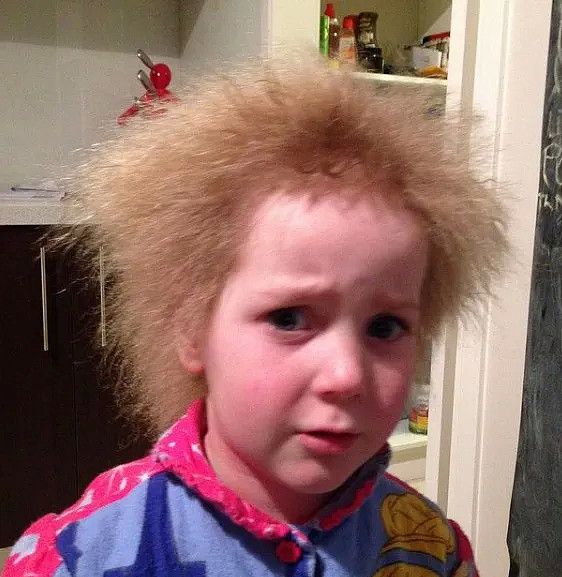 10岁墨尔本女孩，因一头“世界最怪”头发，饱受霸凌上热搜！给所有澳洲父母都上了一课（组图） - 13