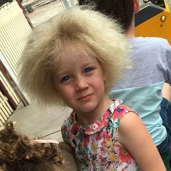 10岁墨尔本女孩，因一头“世界最怪”头发，饱受霸凌上热搜！给所有澳洲父母都上了一课（组图） - 25