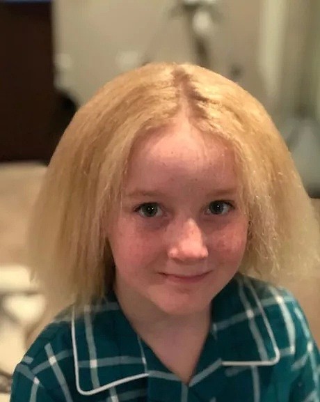 10岁墨尔本女孩，因一头“世界最怪”头发，饱受霸凌上热搜！给所有澳洲父母都上了一课（组图） - 34