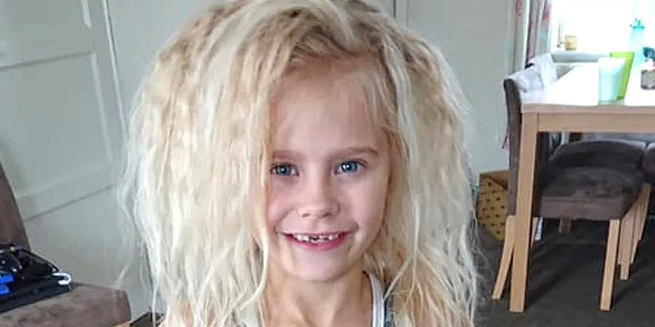 10岁墨尔本女孩，因一头“世界最怪”头发，饱受霸凌上热搜！给所有澳洲父母都上了一课（组图） - 36