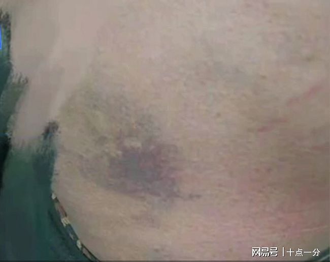 中国13岁女生被校长强迫承认有性行为，医检显示处女膜完整（视频/组图） - 1