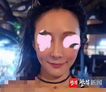 女子整容后山根晃动鼻尖发白，手术方：很成功（组图） - 7