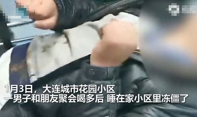 男子醉酒后露宿街头被冻僵，医生称手脚很难保住，家属崩溃（组图） - 1